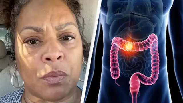 A woman diagnosed with stage 3 colon cancer shares the five warning signs she overlooked.