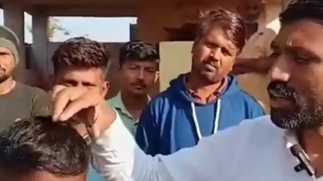 Health officials in India have raised alarms over a mysterious virus linked to a sudden outbreak of hair loss, prompting an investigation into the unusual infection.