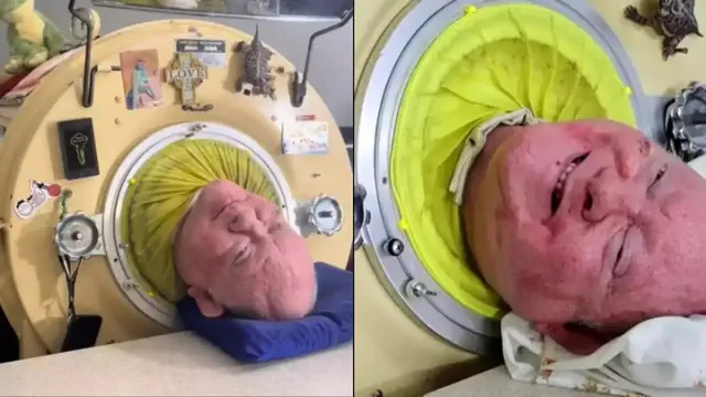 How a man lived for 70 years in an 'iron lung' before passing away last year